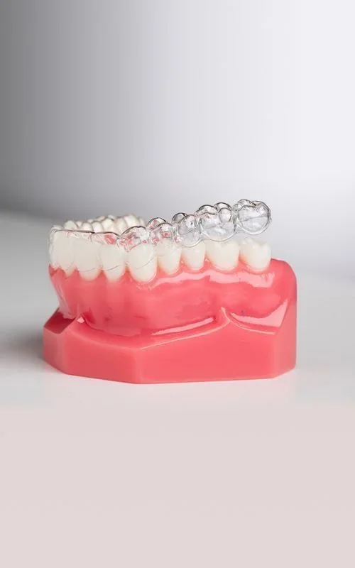 Retenedores Dentales, tratamiento dental en Clínica Beauty Line, La Serena