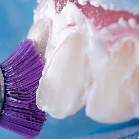Limpieza Dental Profesional, tratamiento dental en Clínica Beauty Line, La Serena